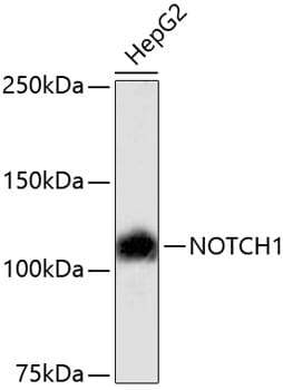 Western blot analysis of extracts of HepG2 cells, using Anti-NOTCH1 Antibody (A11056).
Secondary antibody: Goat Anti-Rabbit IgG (H+L) (HRP) (AS014) at 1:10,000 dilution.
Lysates / proteins: 25µg per lane.
Blocking buffer: 3% non-fat dry milk in TBST.