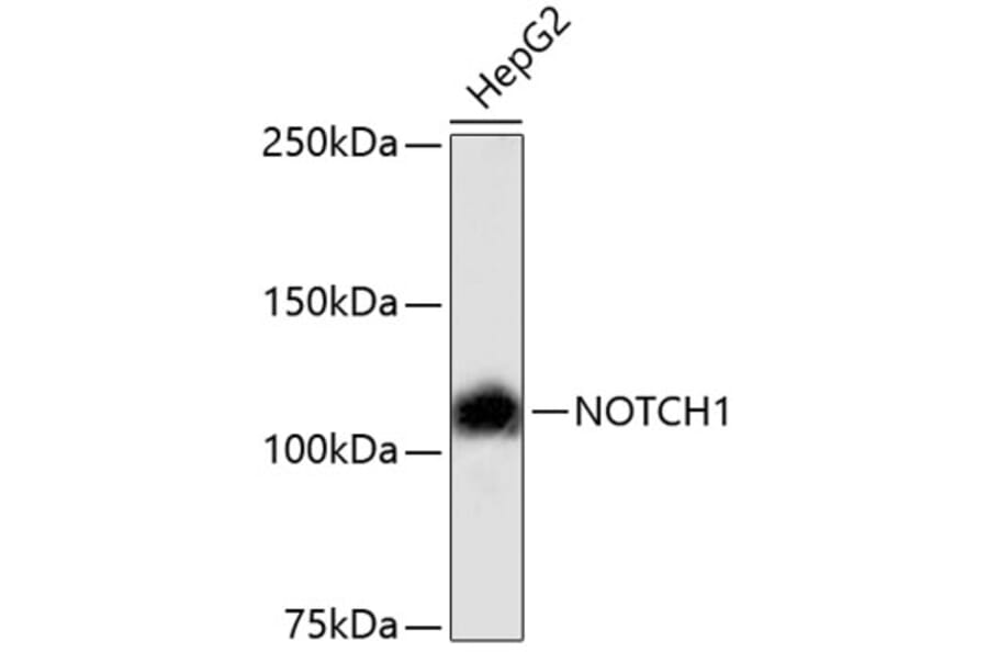 Western Blot - Anti-NOTCH1 Antibody (A11056) - Antibodies.com