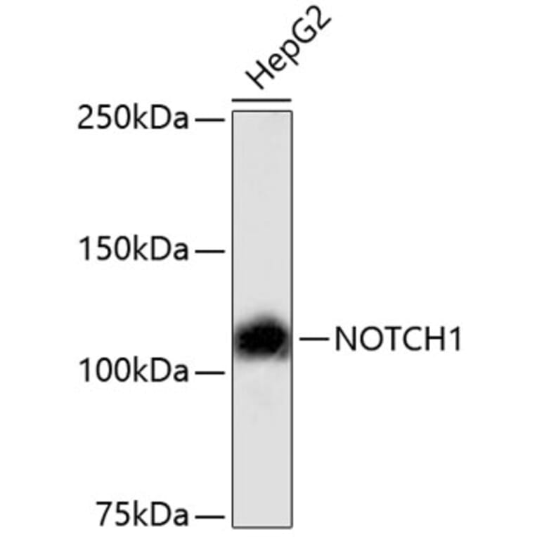 Western Blot - Anti-NOTCH1 Antibody (A11056) - Antibodies.com