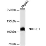 Western Blot - Anti-NOTCH1 Antibody (A11056) - Antibodies.com
