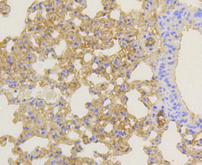 Immunohistochemistry of paraffin-embedded mouse lung using Anti-NOTCH1 Antibody (A11056) at dilution of 1:100 (40x lens).