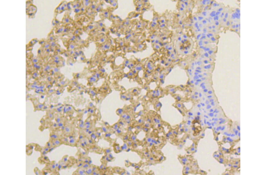 Immunohistochemistry - Anti-NOTCH1 Antibody (A11056) - Antibodies.com