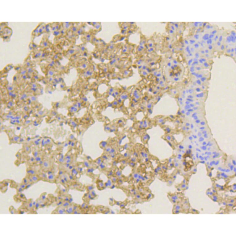 Immunohistochemistry - Anti-NOTCH1 Antibody (A11056) - Antibodies.com