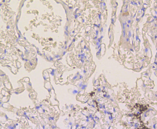 Immunohistochemistry of paraffin-embedded human lung using Anti-NOTCH1 Antibody (A11056) at dilution of 1:100 (40x lens).