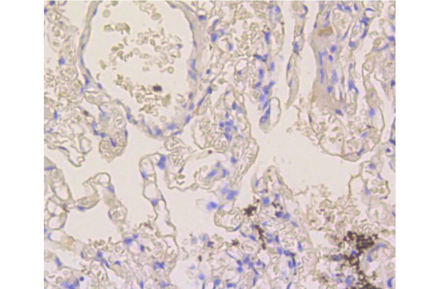 Immunohistochemistry - Anti-NOTCH1 Antibody (A11056) - Antibodies.com