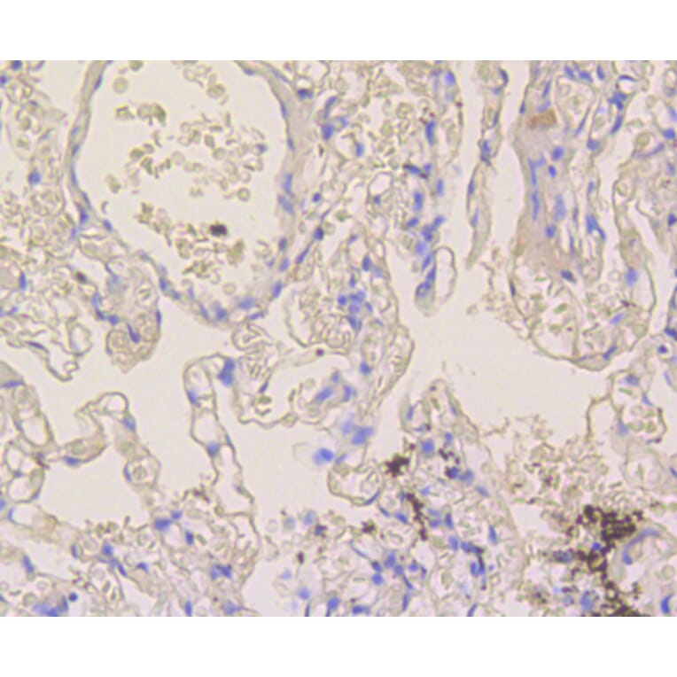 Immunohistochemistry - Anti-NOTCH1 Antibody (A11056) - Antibodies.com