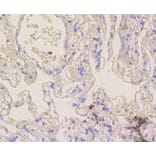 Immunohistochemistry - Anti-NOTCH1 Antibody (A11056) - Antibodies.com