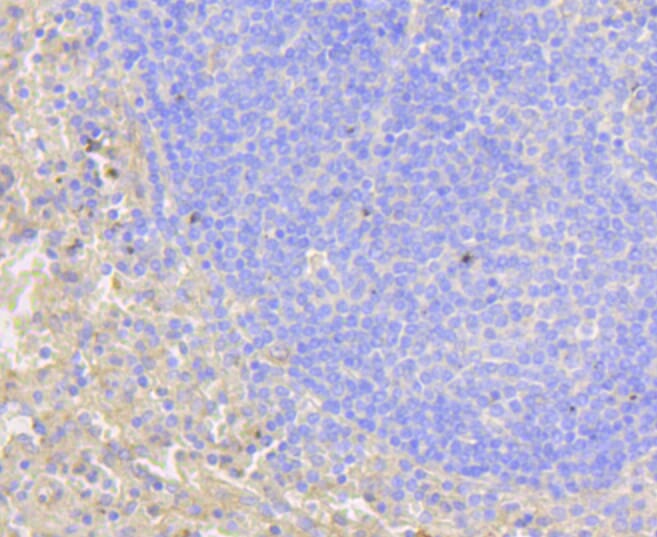 Immunohistochemistry of paraffin-embedded human spleen using Anti-NOTCH1 Antibody (A11056) at dilution of 1:100 (40x lens).