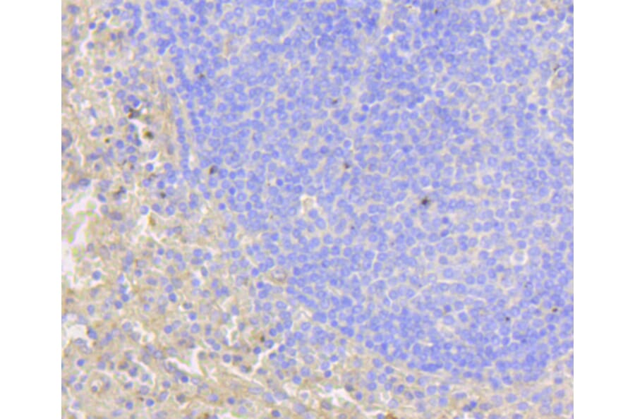Immunohistochemistry - Anti-NOTCH1 Antibody (A11056) - Antibodies.com