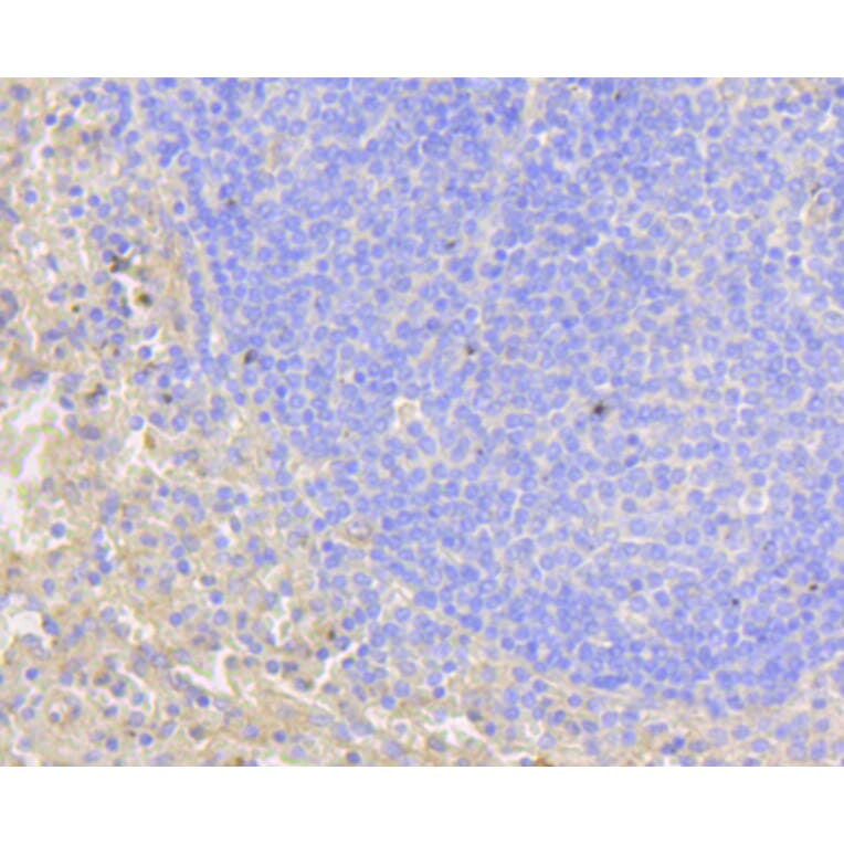 Immunohistochemistry - Anti-NOTCH1 Antibody (A11056) - Antibodies.com