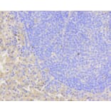 Immunohistochemistry - Anti-NOTCH1 Antibody (A11056) - Antibodies.com