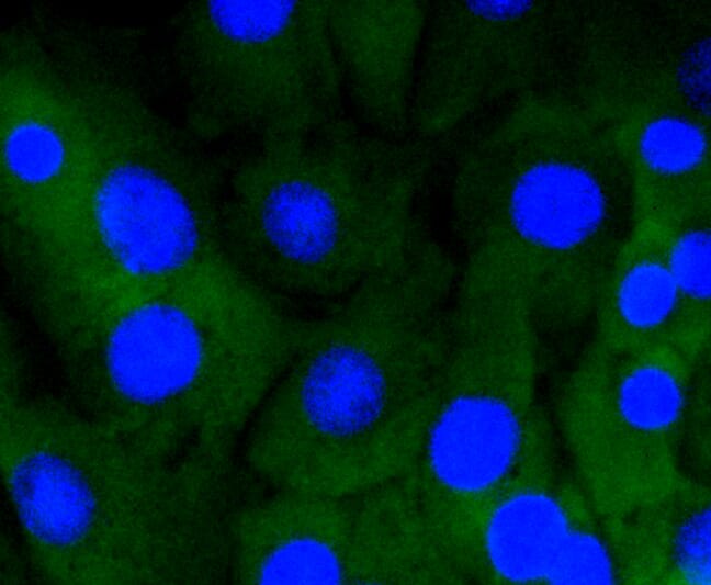 Immunofluorescence analysis of NIH-3T3 cells using Anti-NOTCH1 Antibody (A11056).