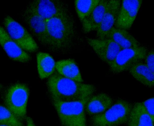 Immunofluorescence analysis of HeLa cells using Anti-NOTCH1 Antibody (A11056).