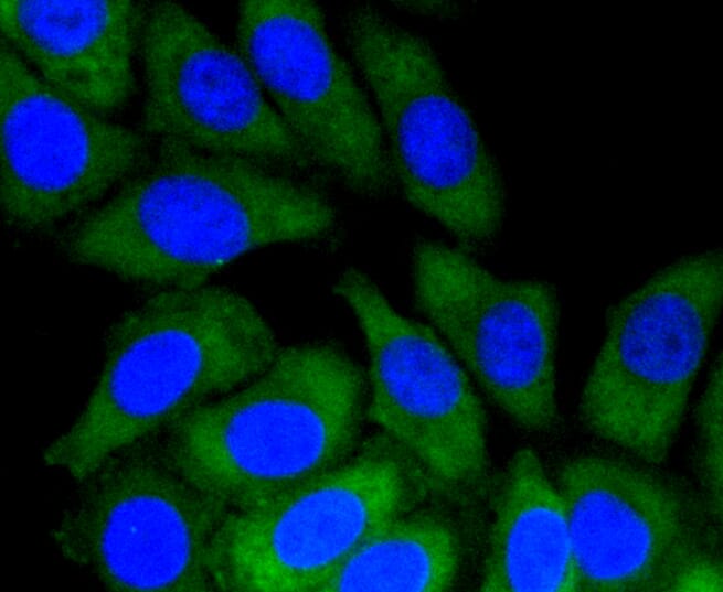 Immunofluorescence analysis of HepG2 cells using Anti-NOTCH1 Antibody (A11056).