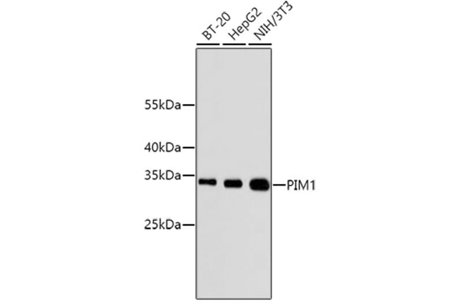 Western Blot - Anti-PIM1 Antibody (A11080) - Antibodies.com
