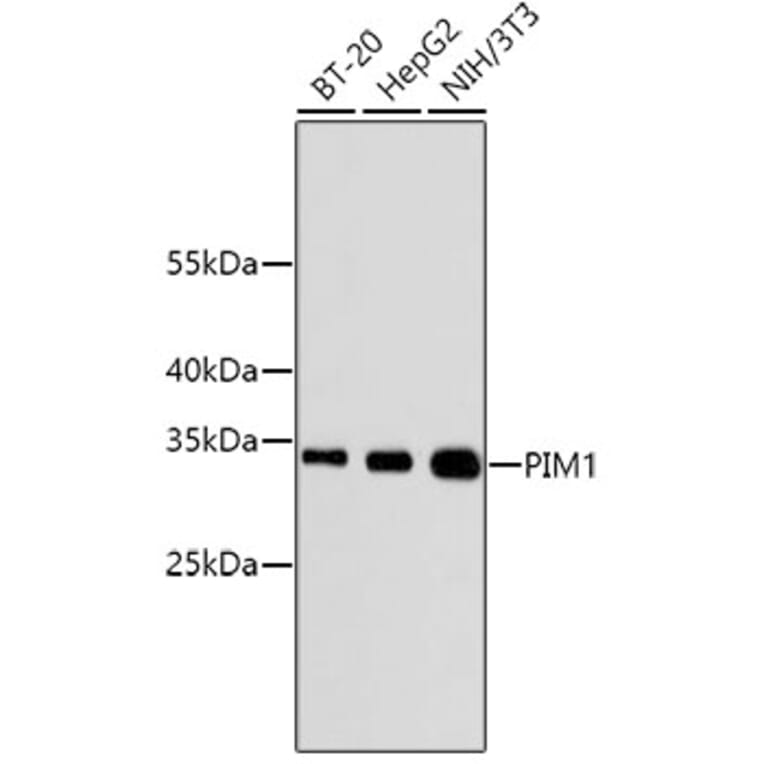 Western Blot - Anti-PIM1 Antibody (A11080) - Antibodies.com