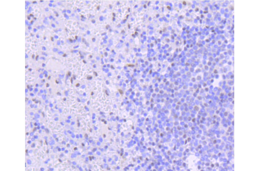 Immunohistochemistry - Anti-PIM1 Antibody (A11080) - Antibodies.com