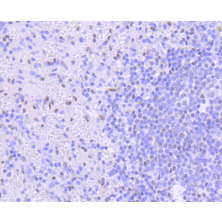 Immunohistochemistry - Anti-PIM1 Antibody (A11080) - Antibodies.com