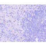Immunohistochemistry - Anti-PIM1 Antibody (A11080) - Antibodies.com