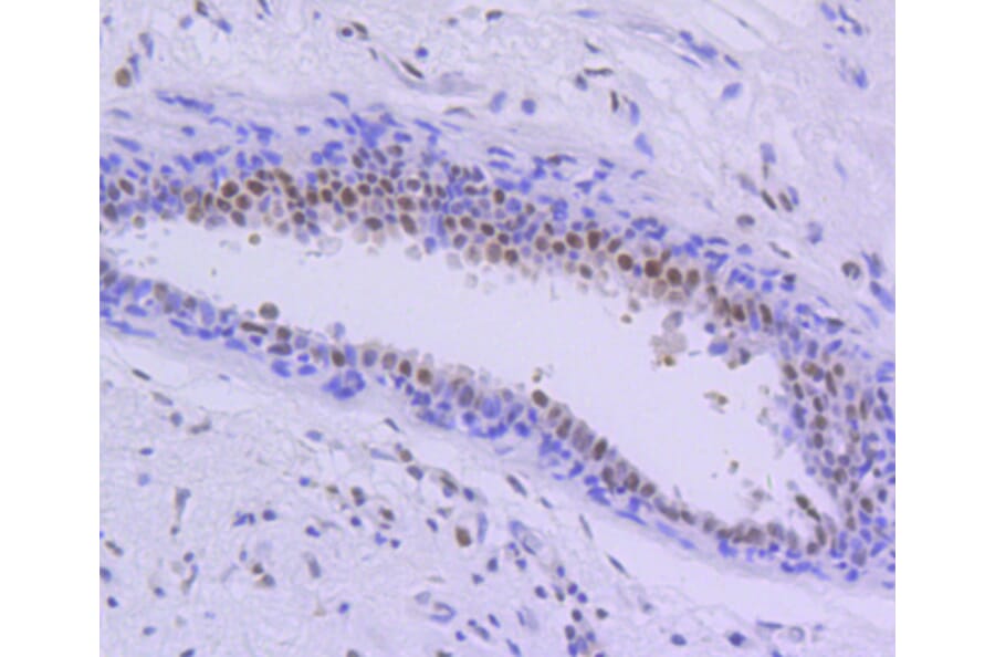 Immunohistochemistry - Anti-PIM1 Antibody (A11080) - Antibodies.com