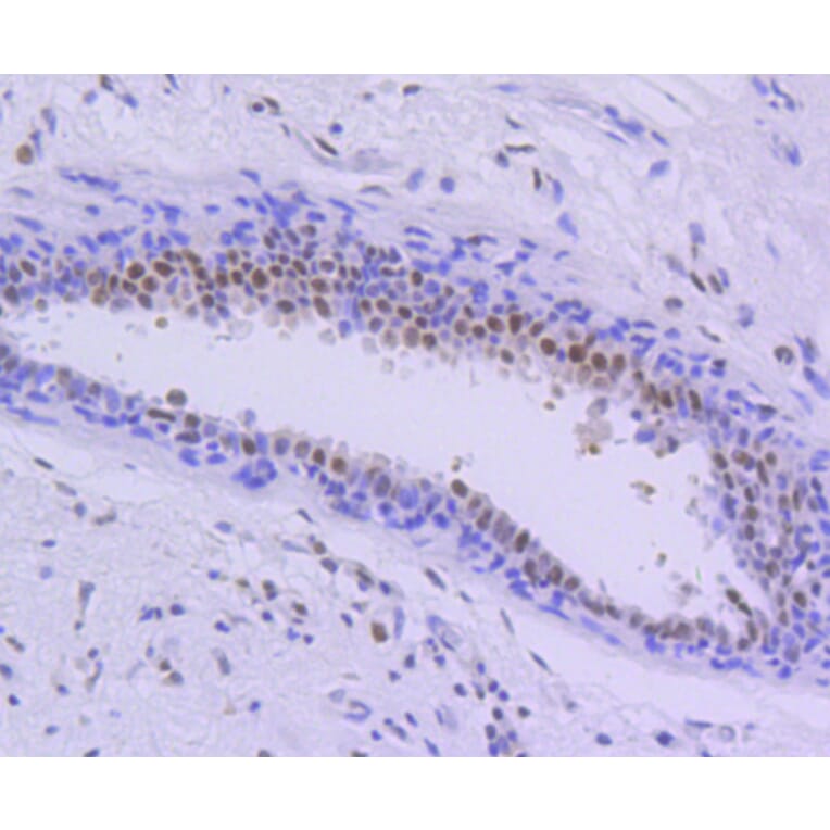 Immunohistochemistry - Anti-PIM1 Antibody (A11080) - Antibodies.com
