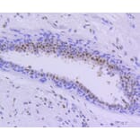 Immunohistochemistry - Anti-PIM1 Antibody (A11080) - Antibodies.com
