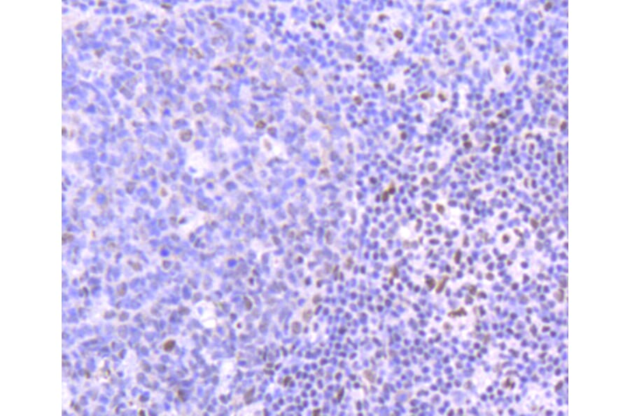 Immunohistochemistry - Anti-PIM1 Antibody (A11080) - Antibodies.com