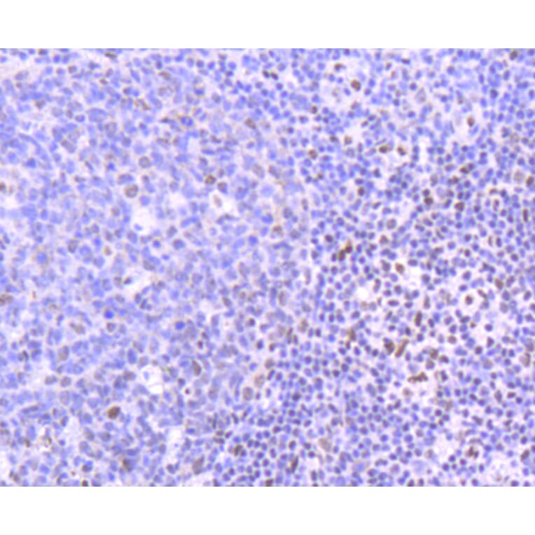 Immunohistochemistry - Anti-PIM1 Antibody (A11080) - Antibodies.com