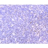 Immunohistochemistry - Anti-PIM1 Antibody (A11080) - Antibodies.com