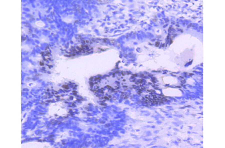 Immunohistochemistry - Anti-PIM1 Antibody (A11080) - Antibodies.com