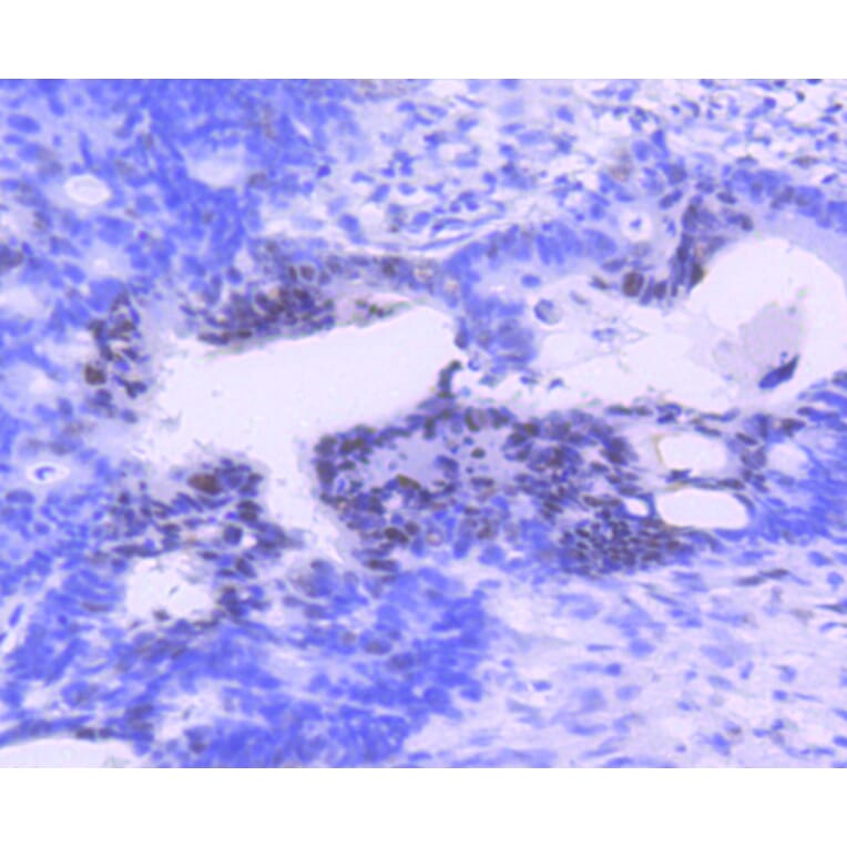 Immunohistochemistry - Anti-PIM1 Antibody (A11080) - Antibodies.com