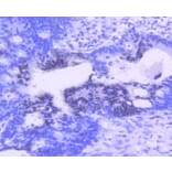 Immunohistochemistry - Anti-PIM1 Antibody (A11080) - Antibodies.com