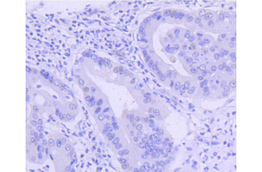 Immunohistochemistry - Anti-PIM1 Antibody (A11080) - Antibodies.com