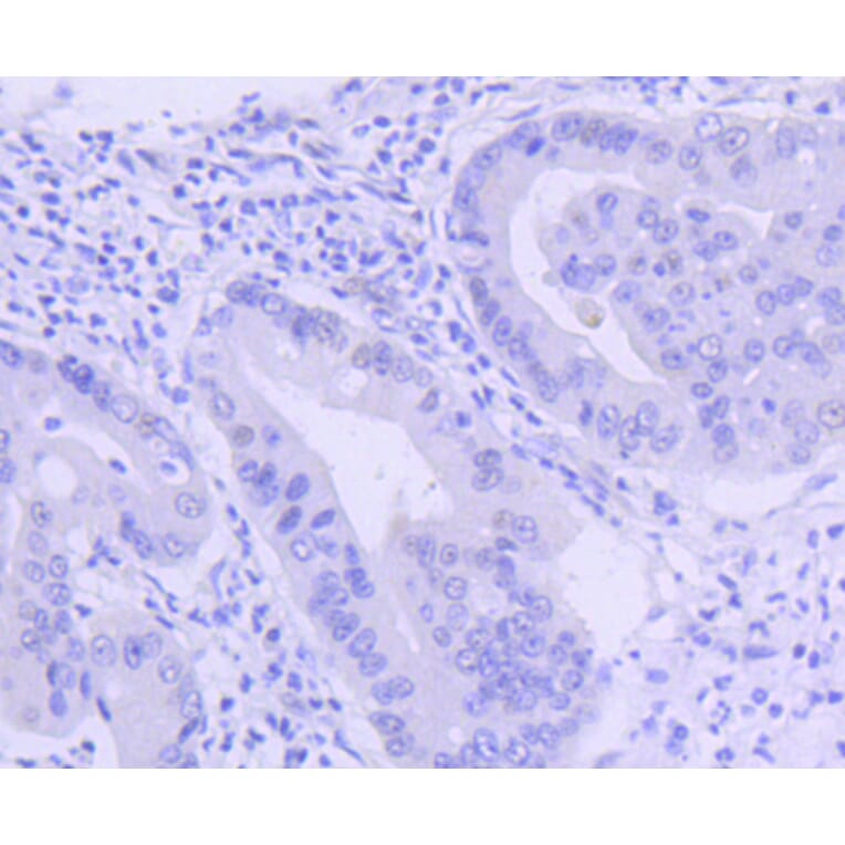 Immunohistochemistry - Anti-PIM1 Antibody (A11080) - Antibodies.com