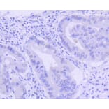 Immunohistochemistry - Anti-PIM1 Antibody (A11080) - Antibodies.com