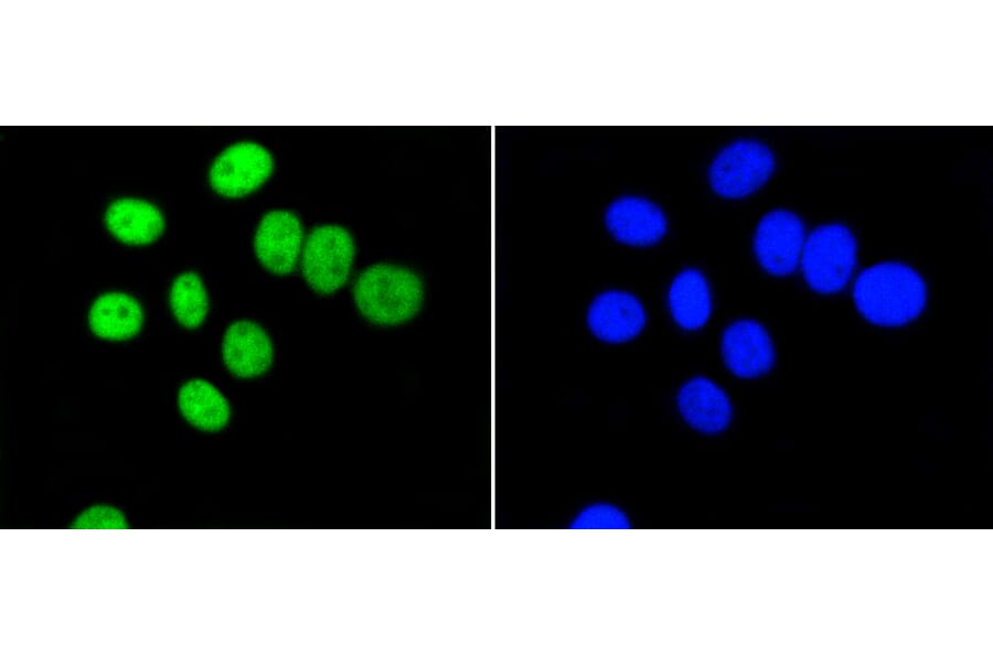Immunofluorescence - Anti-PIM1 Antibody (A11080) - Antibodies.com