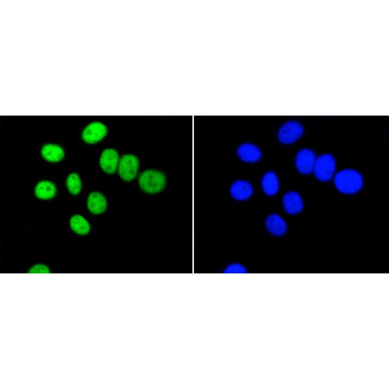 Immunofluorescence - Anti-PIM1 Antibody (A11080) - Antibodies.com