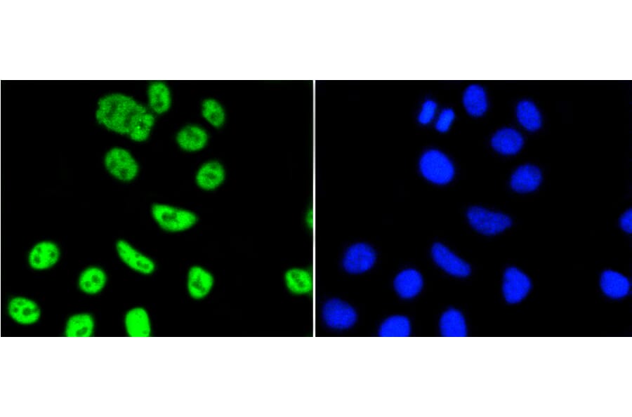 Immunofluorescence - Anti-PIM1 Antibody (A11080) - Antibodies.com