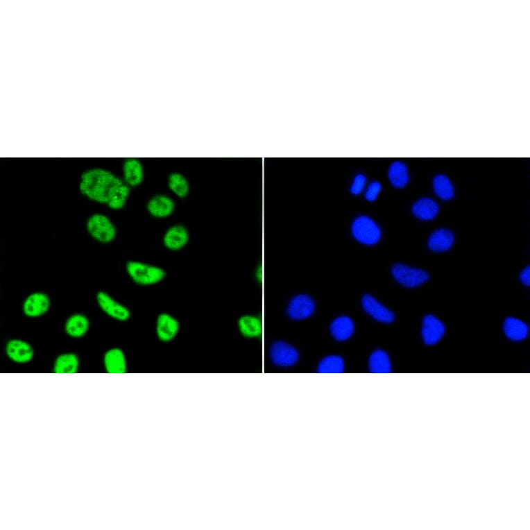 Immunofluorescence - Anti-PIM1 Antibody (A11080) - Antibodies.com