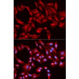 Immunofluorescence - Anti-BCL2L13 Antibody (A1109) - Antibodies.com
