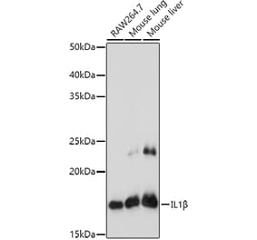 Western Blot - Anti-IL-1 beta Antibody (A11404) - Antibodies.com