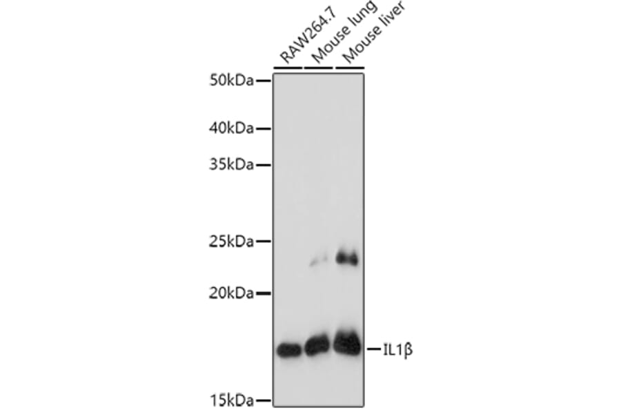 Western Blot - Anti-IL-1 beta Antibody (A11404) - Antibodies.com