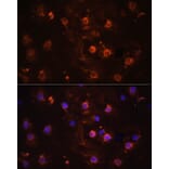 Immunofluorescence - Anti-IL-1 beta Antibody (A11404) - Antibodies.com