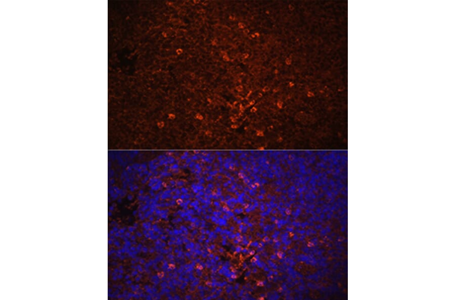 Immunofluorescence - Anti-IL-1 beta Antibody (A11404) - Antibodies.com