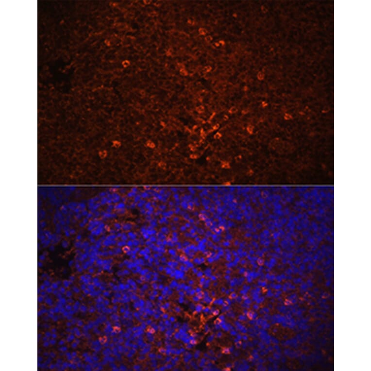 Immunofluorescence - Anti-IL-1 beta Antibody (A11404) - Antibodies.com