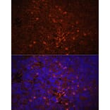 Immunofluorescence - Anti-IL-1 beta Antibody (A11404) - Antibodies.com