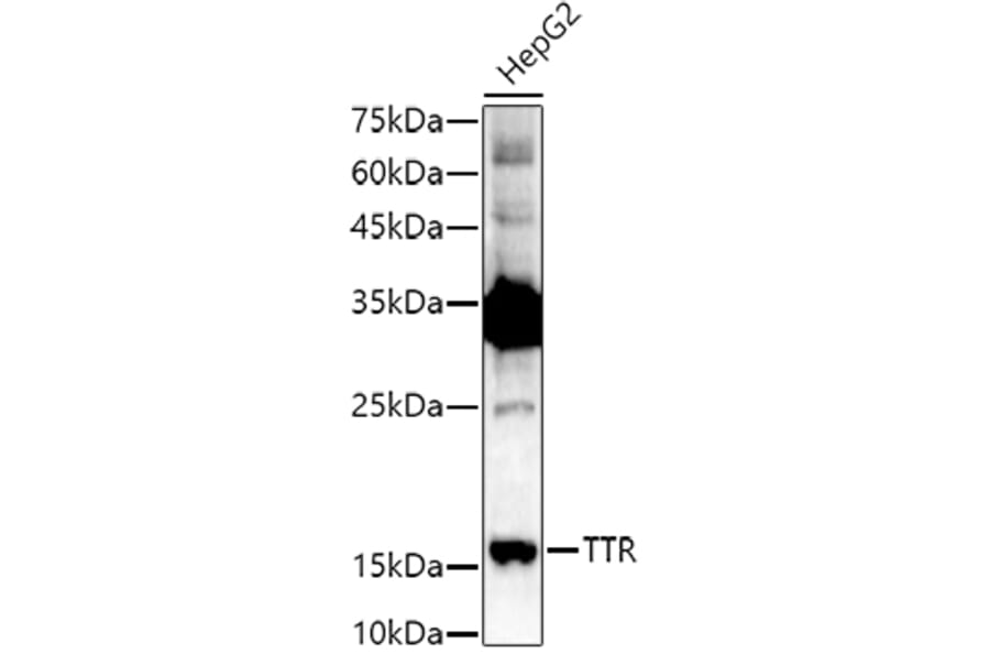 Western Blot - Anti-Prealbumin Antibody (A11408) - Antibodies.com