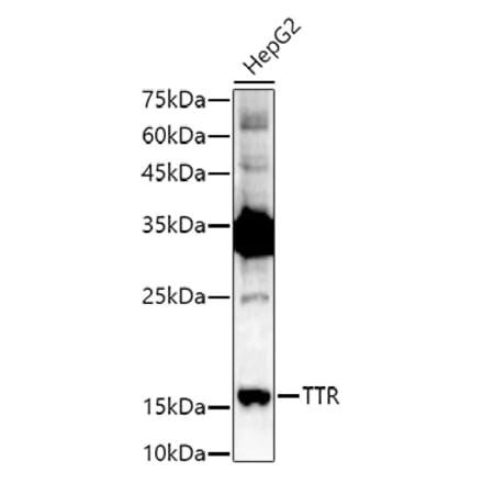Western Blot - Anti-Prealbumin Antibody (A11408) - Antibodies.com