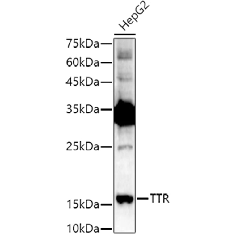 Western Blot - Anti-Prealbumin Antibody (A11408) - Antibodies.com