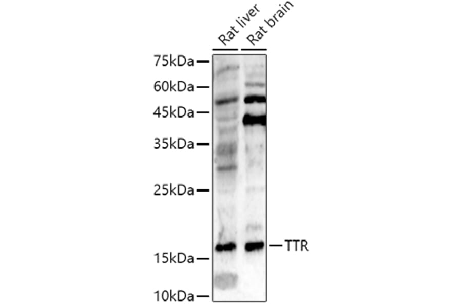 Western Blot - Anti-Prealbumin Antibody (A11408) - Antibodies.com